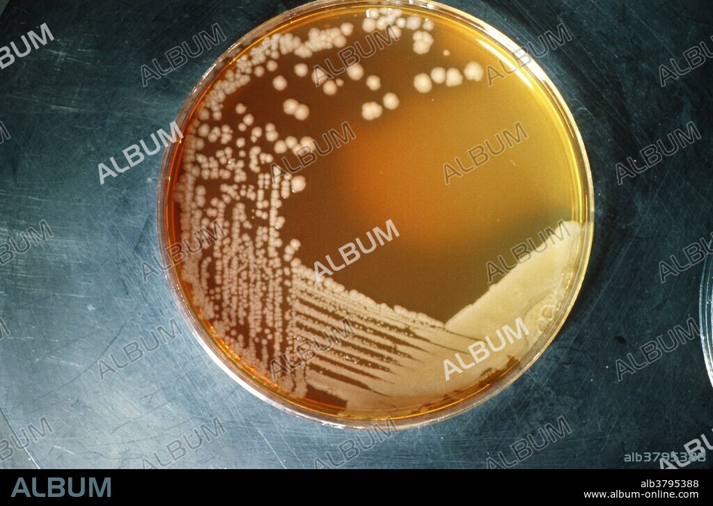 Escherichia coli, usually harmless bacterium that can cause diarrhea, colonies on blood agar eighteen hours after inoculation.
