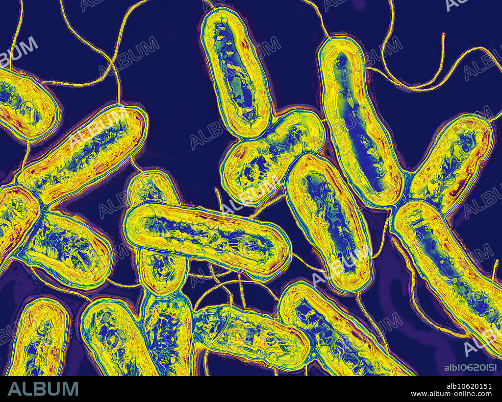 Light micrograph of legionella pneumophila, the bacterium responsible for legionnaire's disease (pneumonia). Image colorization and HDRI treatments. Magnification 1000x.