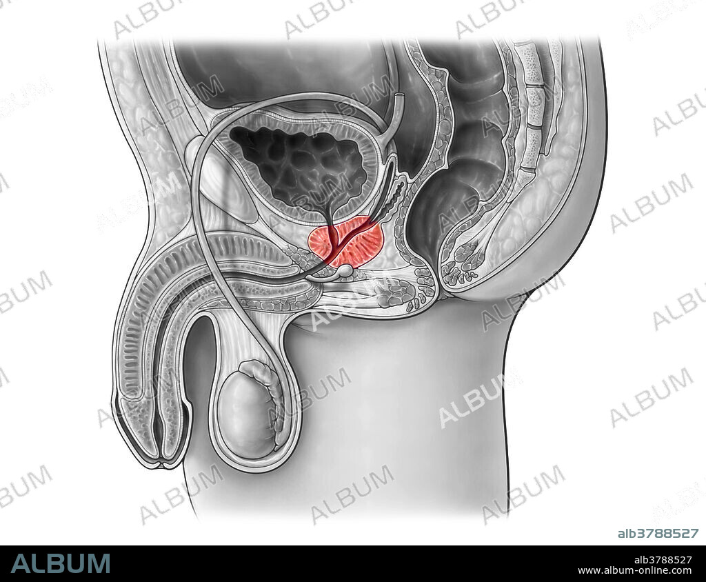 An illustration of the male pelvis from a midsagittal view, highlighting the prostate gland.