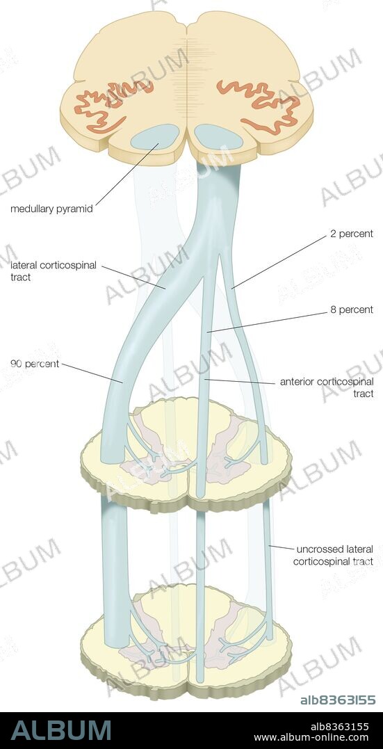 The decussation of the medullary pyramids and the formation of the corticospinal tract in the spinal cord.