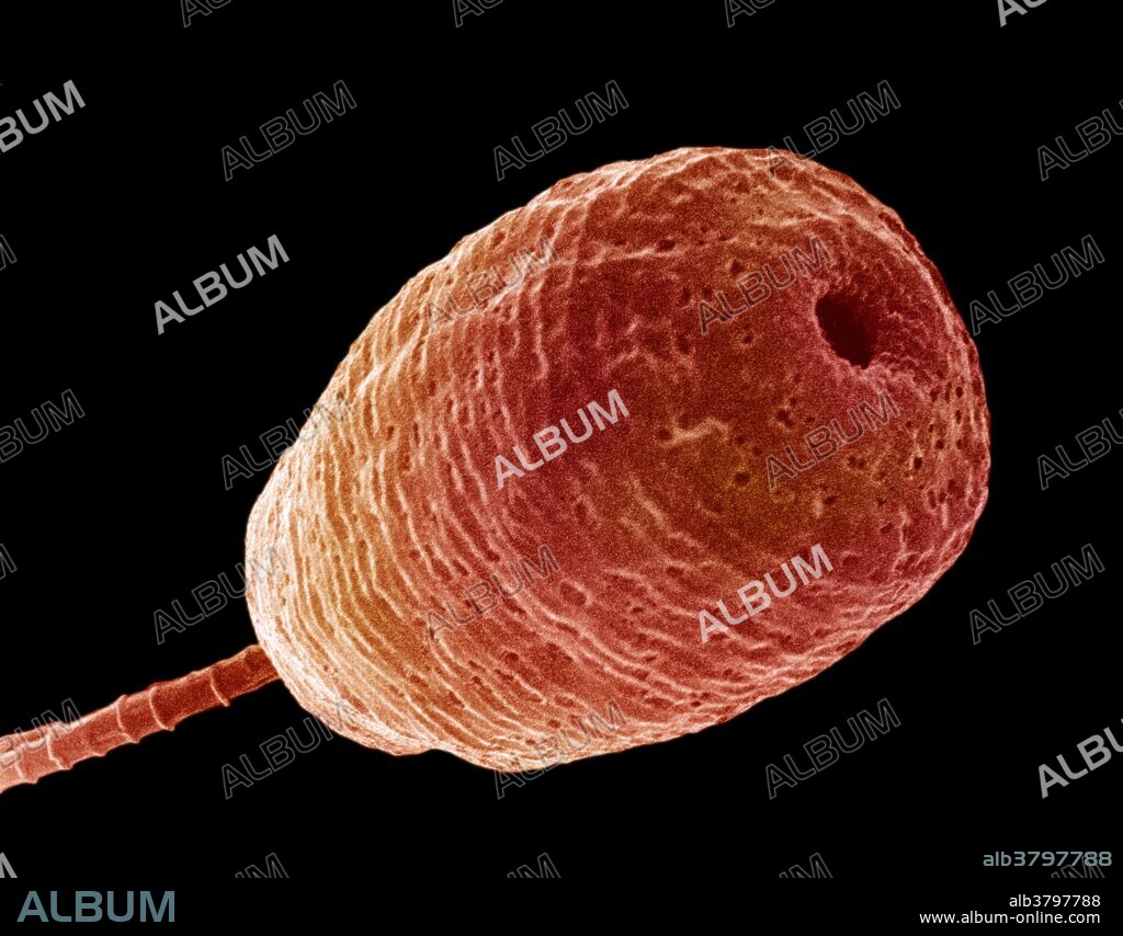 SEM of Vorticella. This protozoa can live in fresh water, salt water or moist soil. They eat bacteria and smaller protozoans. Vorticella attaches itself to plants and algae and sweeps food into its mouth-like opening at the top of the bell with hair like structures called cilia. The fat bell sits on a thin, springy stalk that attaches the creature to objects in the water. By expanding and contracting on its stalk, Vorticella has wider latitude in feeding. X4,000. Original 9m1574.