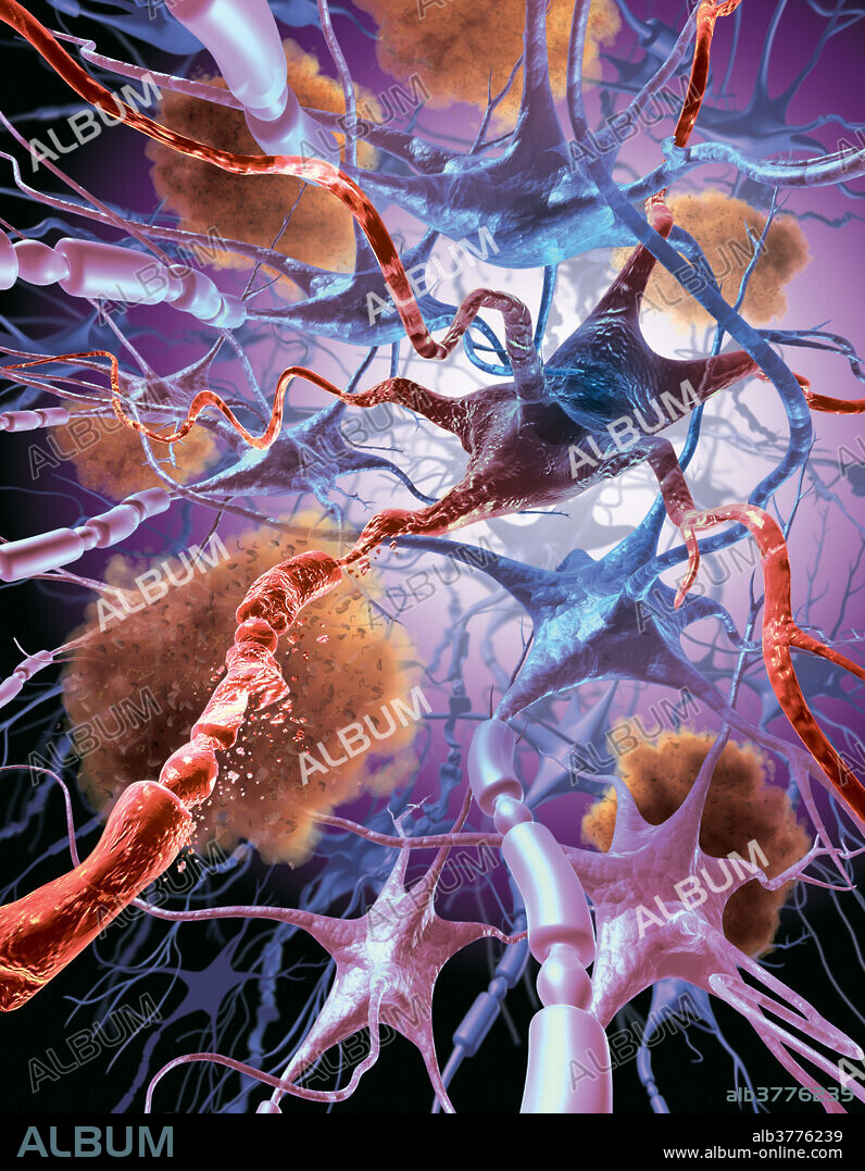 Neuronal Apoptosis In Alzheimer's Disease