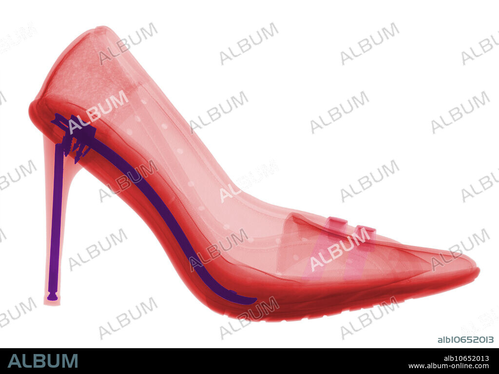 X-ray of a woman's high heel shoes.