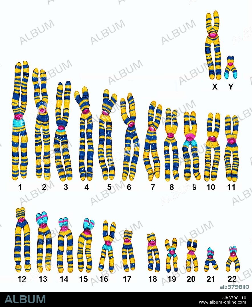 Male Karyotype under a microscope