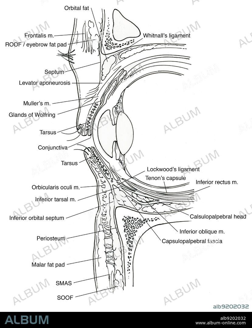 Anatomical illustration of eye, showing, orbital fat, Whitnall's ligament, Tenon's capsule, superior rectus m., levator m., inferior rectus m., Tenon's capsule, calsulopalpebral head, inferior oblique m., capsulopalpebral fascia, SOOF, SMAS, malar fat pad, periosteum, inferior orbital septum, inferior tarsal m., Lockwood's ligament, orbicularis oculi m., tarsus, conjunctiva, glands of Wolfring, Muller's m., levator aponeurosis, septum, orbicularis m., ROOF/eyebrow fat pad, and frontalis m.
