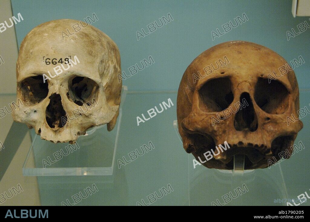 ARTE EGIPCIO. PERIODO TARDIO INICIAL. CRANEOS. Uno de ellos presenta el hueso etmoides (que separa la cavidad nasal del cerebro) intacto por lo que el cerebro no fue retirado por esa vía. El cuerpo no fue momificado totalmente. Fechado después del año 664 a. C. durante la DINASTIA XXVI o SAITA (672-525 a. C.). Procede del cementerio cercano a Tura. El otro presenta perforación del hueso etmoides para tener acceso al cerebro. Su datación es incierta y su procedencia desconocida. Museo Británico. Londres. Inglaterra. Reino Unido.