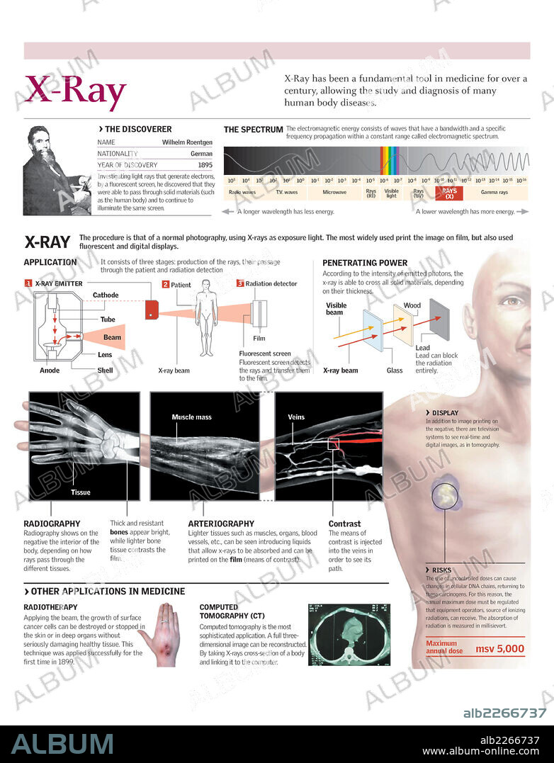 RAYOS X. Infografía del procedimiento de una radiografía y sus aplicaciones en medicina.