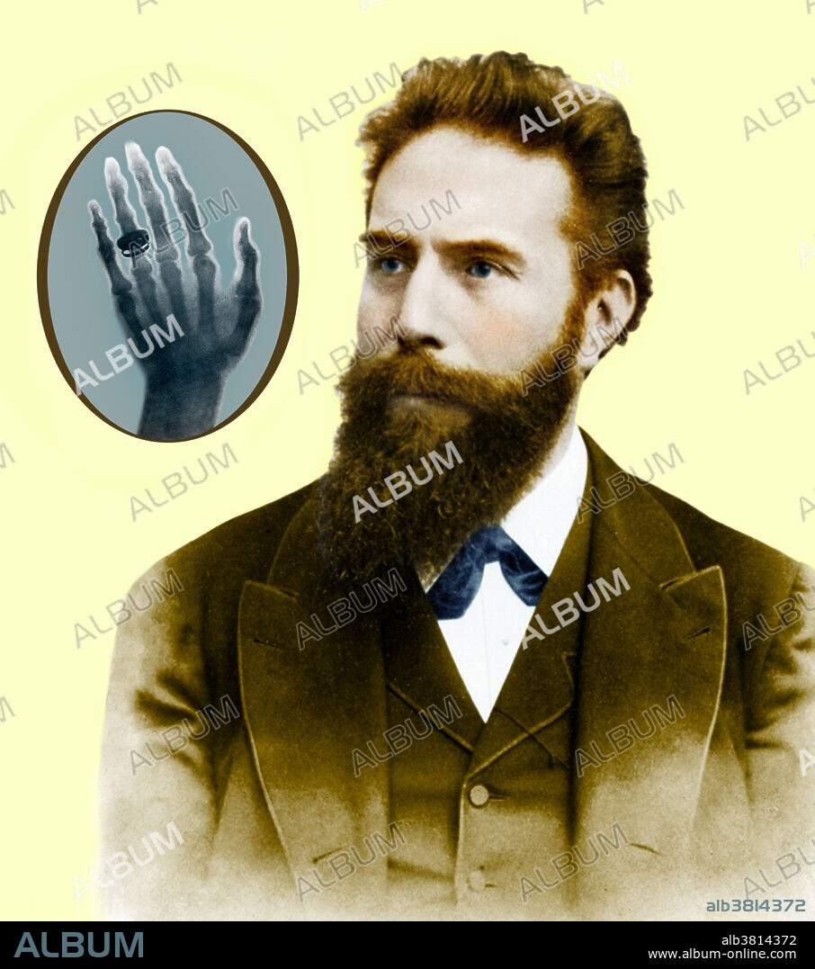 Wilhelm Konrad Roentgen (1845-1923), German experimental physicist and discoverer of x-rays, with inset image of the first medical x-ray, an image of his wife's hand. While using a discharge tube (in which an electric discharge is passed through a gas at low pressure) in a darkened room, Roentgen noticed that a card coated with barium platinocyanide glowed when the tube was switched on. The effect was not blocked by an intervening wall, or even a thin sheet of metal. Roentgen termed this newly discovered phenomenon X-ray radiation, and suggested that it consisted of electromagnetic rays with a shorter wavelength than light. He was awarded the first Nobel Prize for Physics in 1901. Enhancement and composite of 9A8158 and BD9306.