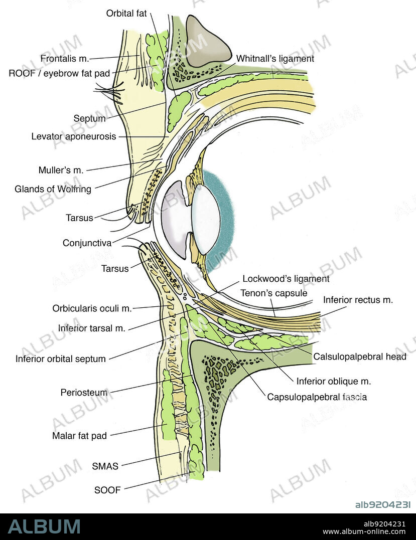 Anatomical illustration of eye, showing, orbital fat, Whitnall's ligament, Tenon's capsule, superior rectus m., levator m., inferior rectus m., Tenon's capsule, calsulopalpebral head, inferior oblique m., capsulopalpebral fascia, SOOF, SMAS, malar fat pad, periosteum, inferior orbital septum, inferior tarsal m., Lockwood's ligament, orbicularis oculi m., tarsus, conjunctiva, glands of Wolfring, Muller's m., levator aponeurosis, septum, orbicularis m., ROOF/eyebrow fat pad, and frontalis m.