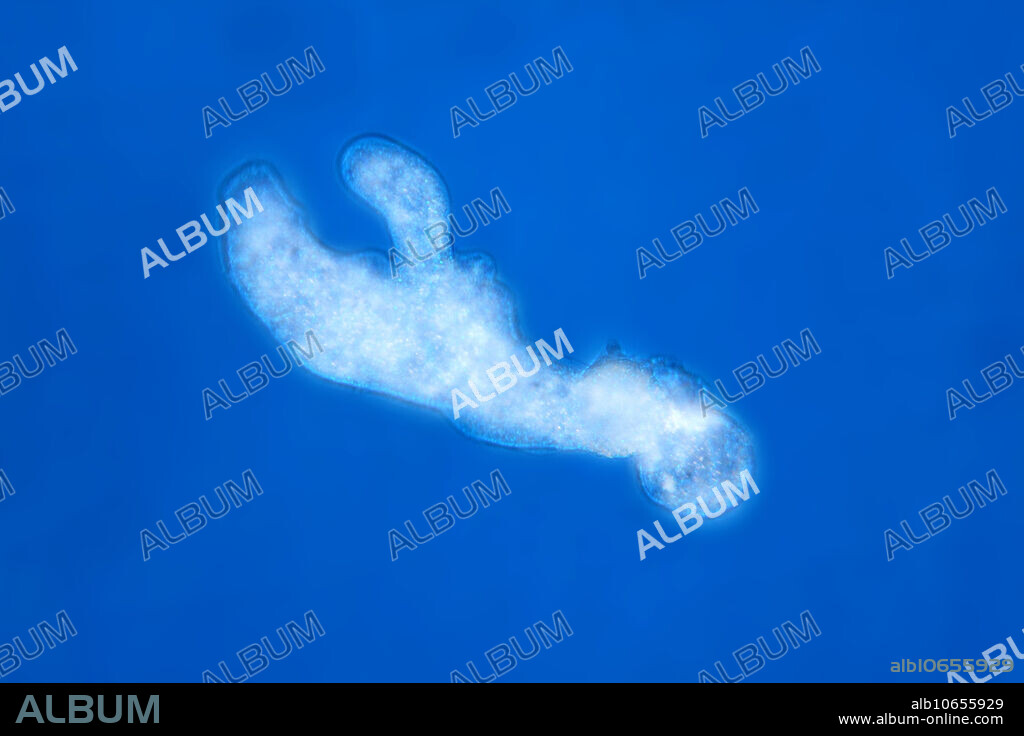 The amoeba (Chaos carolinensis) This image is part of a series showing the locomotion of this species. This series of images shows pseudopodia and protoplasmic flow. BN5965, BN5966, BN5967, BN5969.