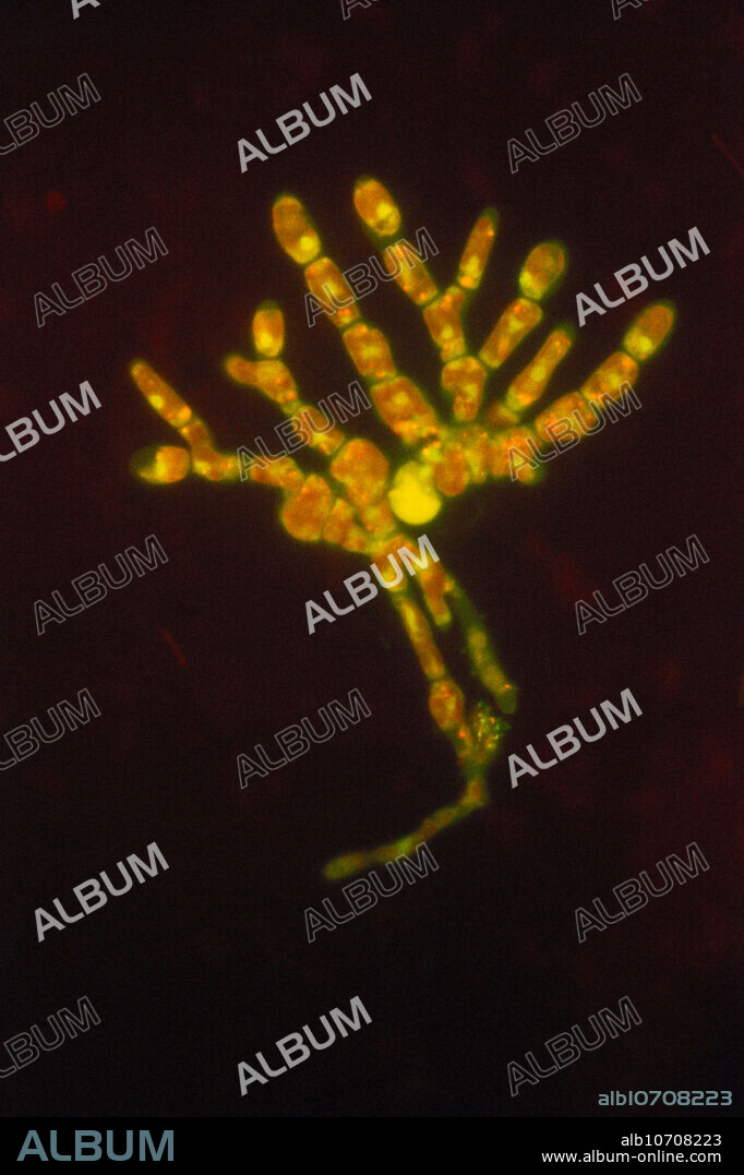 Light micrograph of green algae in the genus Trentepohlia. This filamentous chlorophyte algae lives on terrestrial supports such as tree trunks and wet rocks. The strong orange color of the filaments, which masks the green of the chlorophyll, is caused by the presence of large quantities of carotenoid pigments. Magnification: 60 x at 35mm.