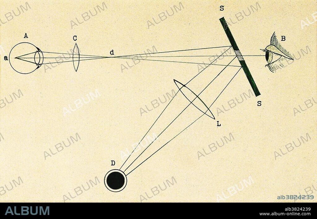 A diagram to show the principle of Helmholtz's ophthalmoscope, 1867. The optical arrangement ensured that the retina of the eye was illuminated by an almost parallel beam of light and that the beam of light was not cut off by the observer. A. The eye of the patient. B. The observer. SS. The mirror. L. and C. Lenses for giving an almost parallel beam of light. Hermann von Helmholtz (1821-1894) was a German physician and physicist who made significant contributions in several scientific fields, including the mathematics of the eye, theories of vision, color vision research, and in work on the conservation of energy, electrodynamics, and thermodynamics.