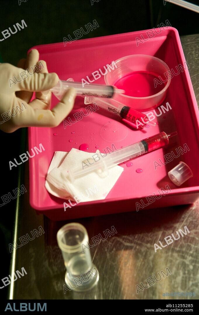 Report from the Gynecological Surgery Department of Antoine-Béclère Hospital (92). Follicular puncture for IVF (in vitro fertilization): collection of follicular fluid containing oocytes.