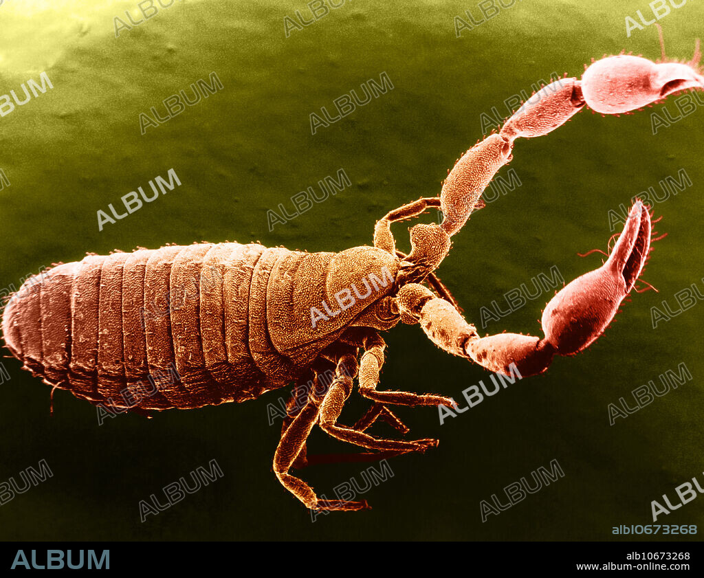 Colour enhanced scanning electron micrograph of an unknown species of pseudoscorpion, about five millimetres long, magnified 35x at 5 x 7 .