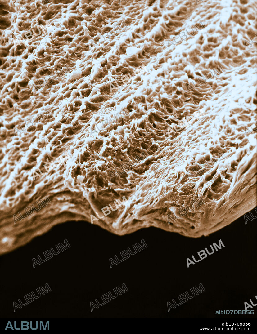 Human Fingernail, under a microscope (SEM)